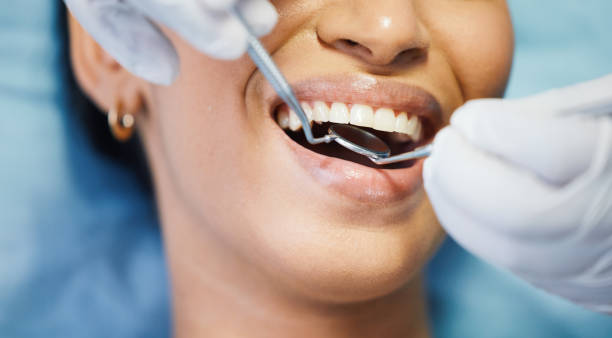 Best Urgent Tooth Repair  in Belwood, NC